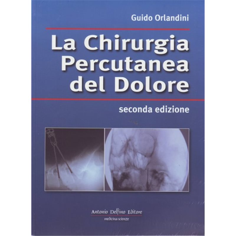 LA CHIRURGIA PERCUTANEA DEL DOLORE 2ª ed.